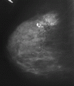 0_1611304_316409.gif